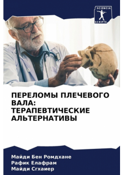 ПЕРЕЛОМЫ ПЛЕЧЕВОГО ВАЛА