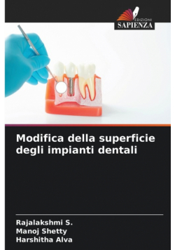 Modifica della superficie degli impianti dentali