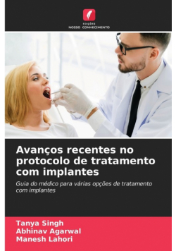 Avanços recentes no protocolo de tratamento com implantes