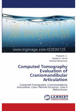 Computed Tomography Evaluation of Craniomandibular Articulation