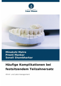 Häufige Komplikationen bei festsitzendem Teilzahnersatz