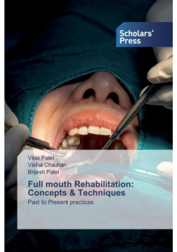 Full mouth Rehabilitation