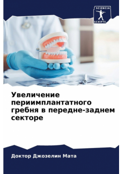 Увеличение периимплантатного гребня в передне-заднем секторе