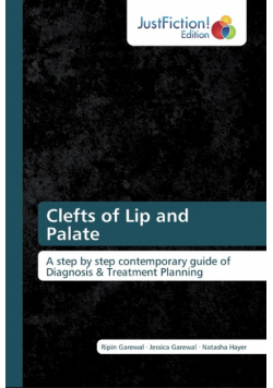 Clefts of Lip and Palate