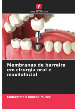 Membranas de barreira em cirurgia oral e maxilofacial