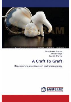 A Craft To Graft