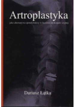 Artroplastyka