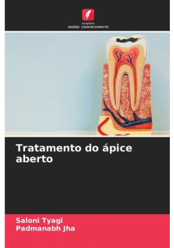 Tratamento do ápice aberto