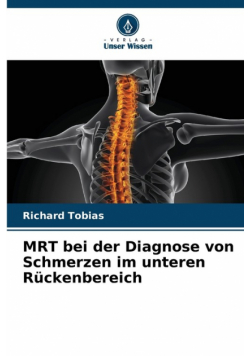MRT bei der Diagnose von Schmerzen im unteren Rückenbereich