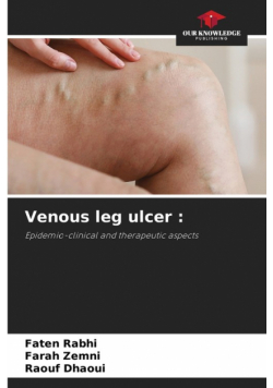 Venous leg ulcer