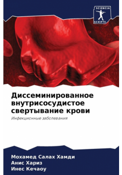 Диссеминированное внутрисосудистое свертывание крови