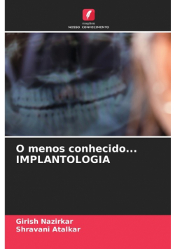 O menos conhecido... IMPLANTOLOGIA