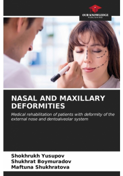 Nasal And Maxillary Deformities
