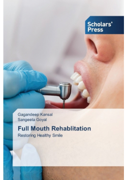 Full Mouth Rehablitation
