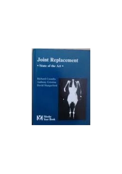 Joint Replacement State of the art