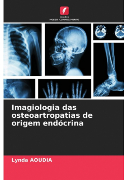 Imagiologia das osteoartropatias de origem endócrina