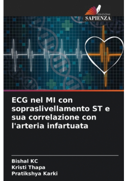 ECG nel MI con sopraslivellamento ST e sua correlazione con l'arteria infartuata