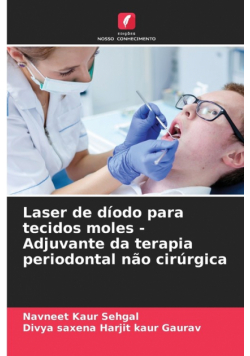 Laser de díodo para tecidos moles - Adjuvante da terapia periodontal não cirúrgica