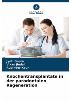 Knochentransplantate in der parodontalen Regeneration