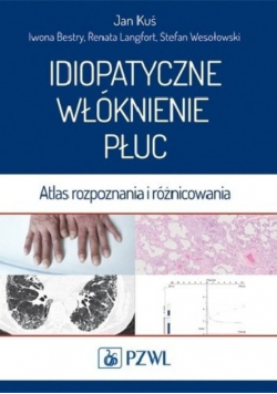 Idiopatyczne włóknienie płuc
