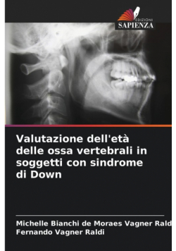 Valutazione dell'età delle ossa vertebrali in soggetti con sindrome di Down