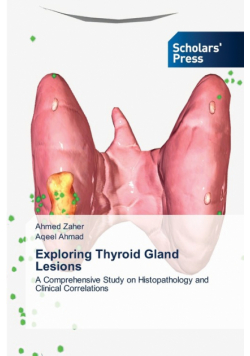 Exploring Thyroid Gland Lesions