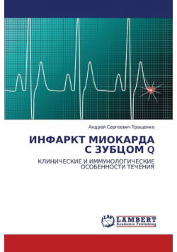 Infarkt Miokarda S Zubtsom Q