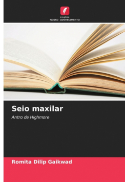 Seio maxilar