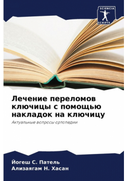 Лечение переломов ключицы с помощью накладок на ключицу