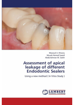 Assessment of Apical Leakage of Different Endodontic Sealers