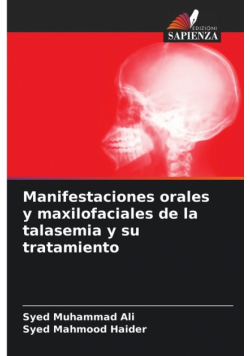 Manifestaciones orales y maxilofaciales de la talasemia y su tratamiento