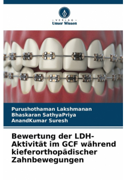 Bewertung der LDH-Aktivität im GCF während kieferorthopädischer Zahnbewegungen