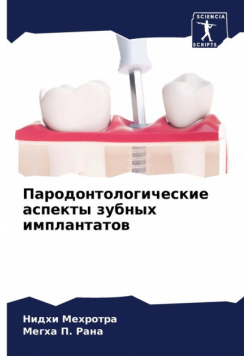 Пародонтологические аспекты зубных имплантатов