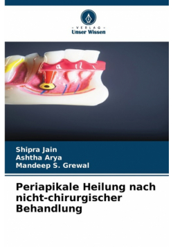Periapikale Heilung nach nicht-chirurgischer Behandlung