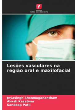 Lesões vasculares na região oral e maxilofacial