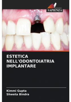 Estetica Nell'odontoiatria Implantare