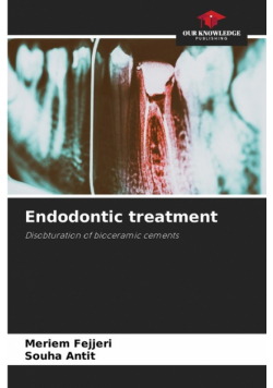 Endodontic treatment