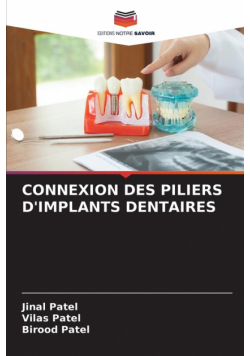 Connexion Des Piliers D'implants Dentaires
