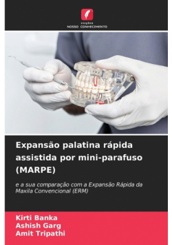 Expansão palatina rápida assistida por mini-parafuso (MARPE)