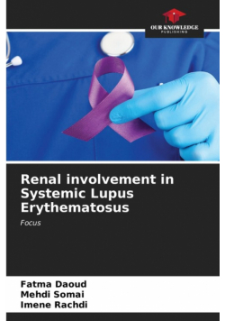 Renal involvement in Systemic Lupus Erythematosus
