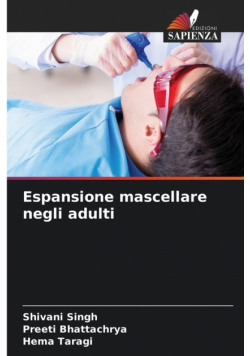 Espansione mascellare negli adulti