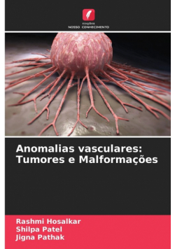 Anomalias vasculares