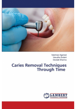 Caries Removal Techniques Through Time