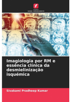 Imagiologia por RM e essência clínica da desmielinização isquémica