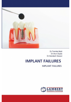 Implant Failures