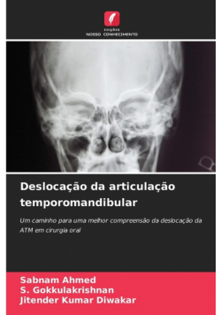 Deslocação da articulação temporomandibular