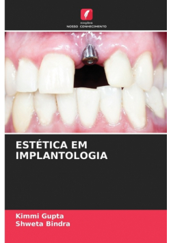Estética Em Implantologia