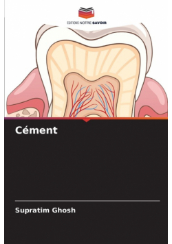 Cément