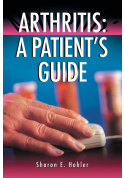 Arthritis