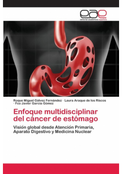 Enfoque multidisciplinar del cáncer de estómago